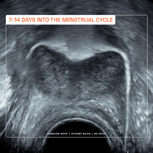 Fertility Scans