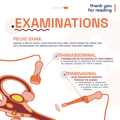 Examinations for Fibroids - Illustration of transabdominal and transvaginal ultrasound procedures with text explanation